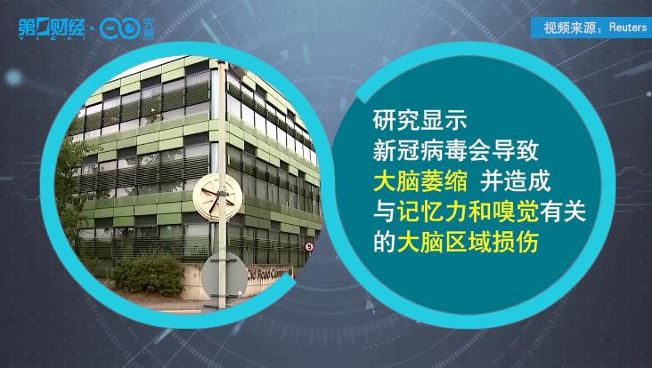 新冠病毒会导致大脑萎缩